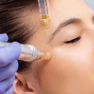 Types of acne scars — ice pick, boxcar and rolling scars explained